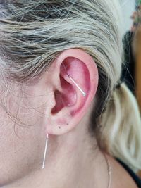 Akupunktiertes Ohr